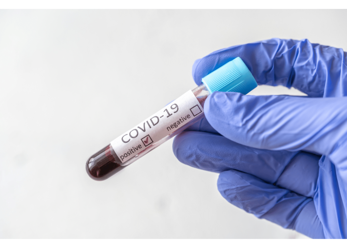 test for the coronavirus